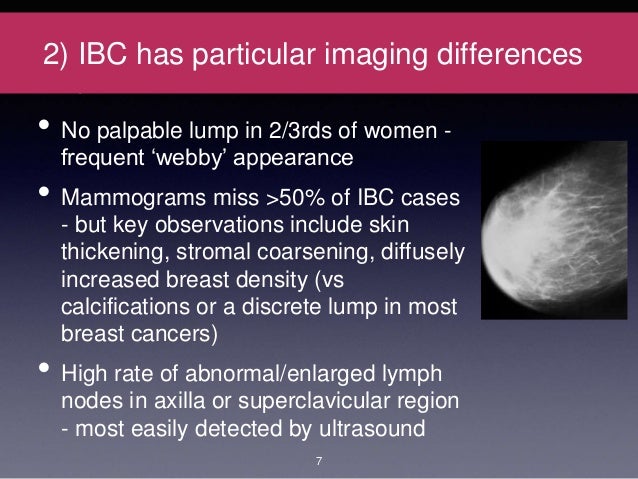 breast abscess vs. ibc Perfect sex video